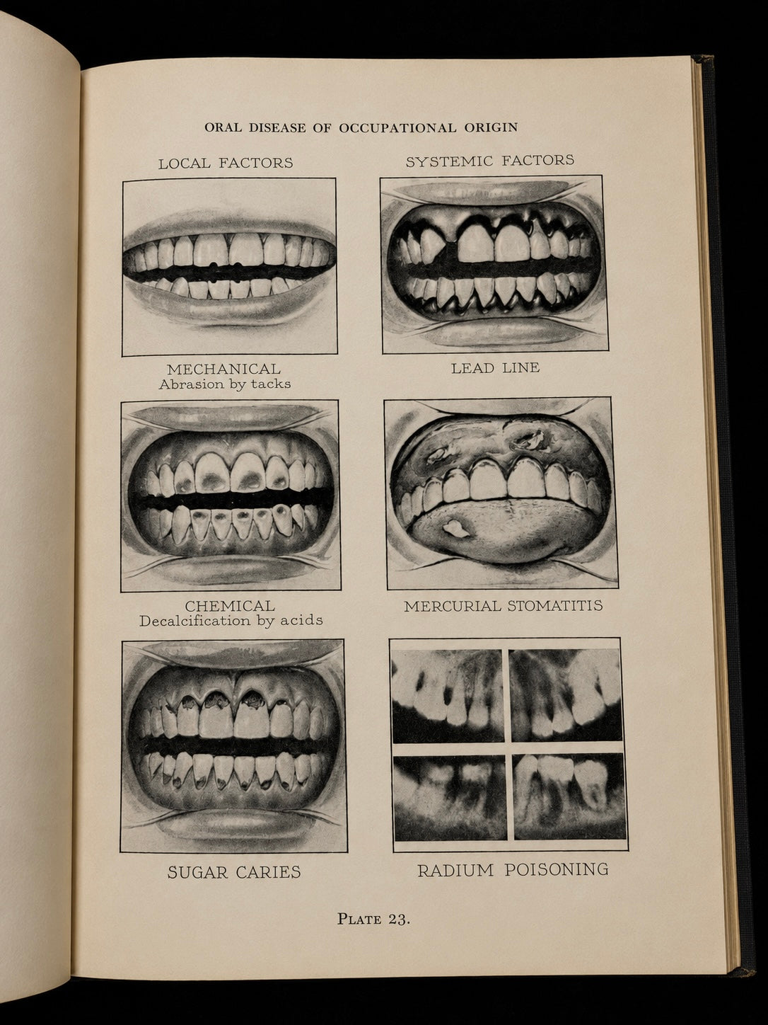 Atlas of the Mouth (1944)
