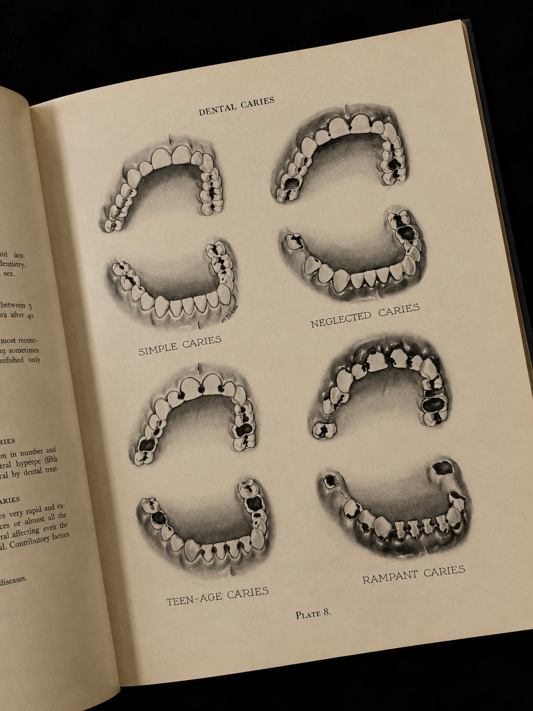 Atlas of the Mouth (1944)