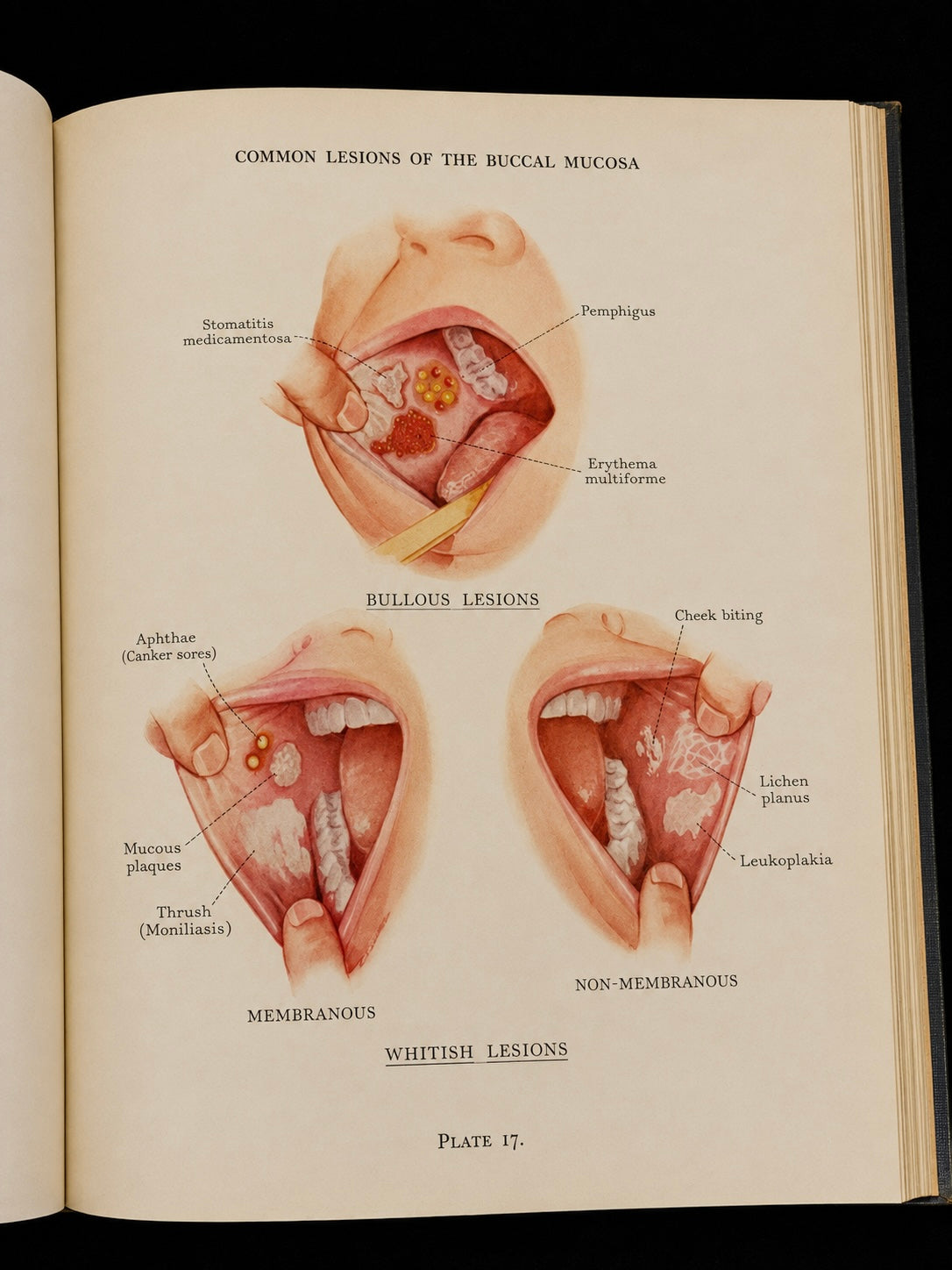 Atlas of the Mouth (1944)